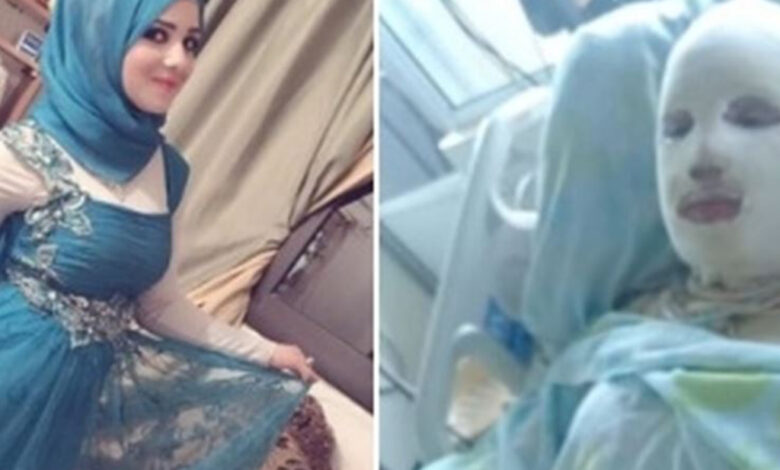 هناء خضر لبنانية أحرقها زوجها حتى الموت وهي حامل