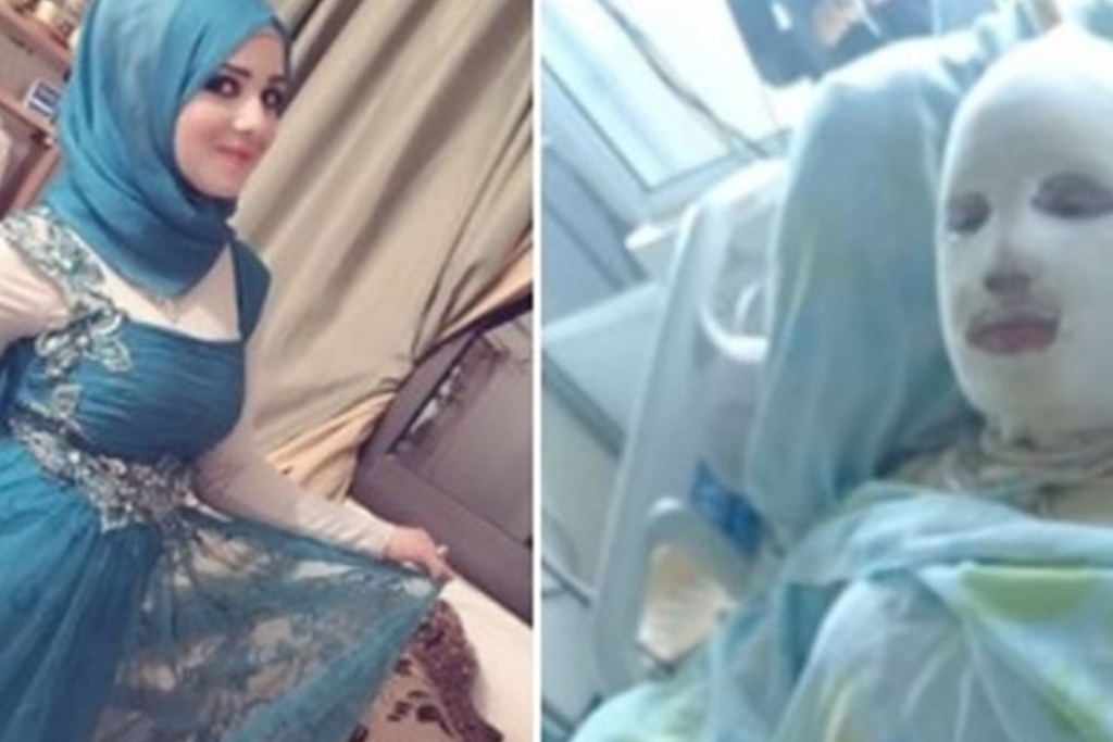 هناء خضر لبنانية أحرقها زوجها حتى الموت وهي حامل